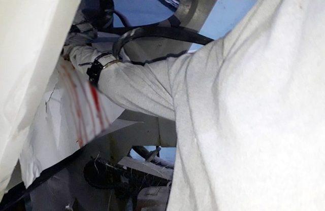 Elini Ambalaj Makinesine Kaptırdı 1