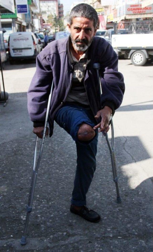 Engellinin Protez Bacağını Çaldılar 2