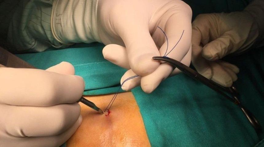 Bilgisayar Bağımlılığı Kıl D&ouml;nmesine De Neden Oluyor