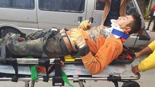 Başkentte Kanalizasyon Çalışması Esnasında Göçük: 1 Ağır Yaralı