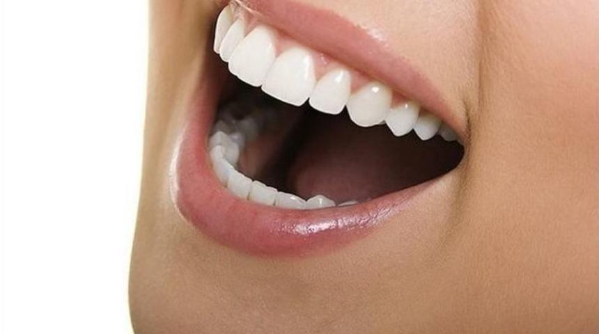 &Ccedil;arpık Dişlere G&ouml;r&uuml;nmez &Ccedil;&ouml;z&uuml;m