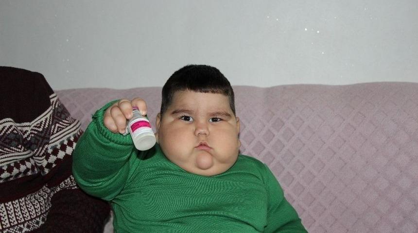 2 Yaşında 37 Kilo Olan Yağız Bebek İlacına Kavuştu