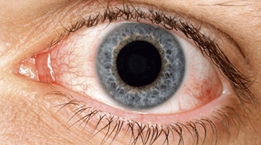 Yeterince Su İ&ccedil;mediğinizin 12 G&ouml;stergesi