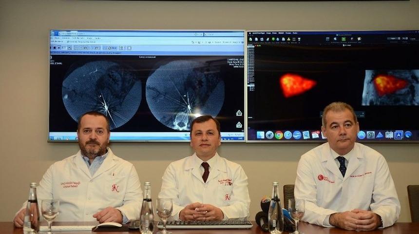 Karaciğer Kanserinde Umut Veren Uygulama T&uuml;rkiye&rsquo;de