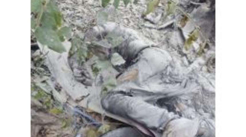 Isınmak İ&ccedil;in Yaktığı Ateşten Yandı