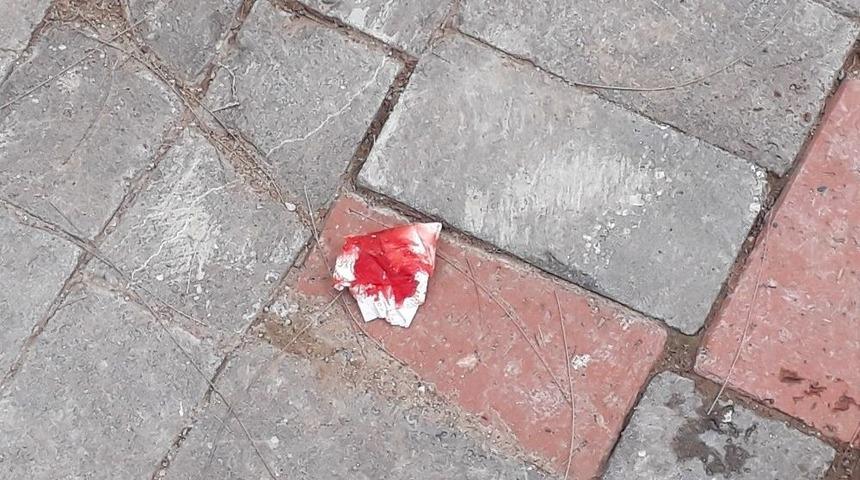 Parkta Oyun Onarken Ayağı İpe Takılan &Ccedil;ocuk Hastanelik Oldu