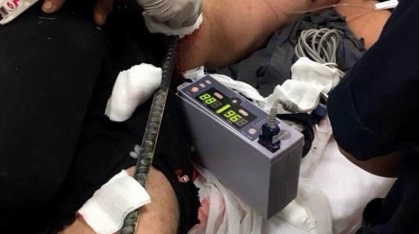 Suriye&rsquo;de &Ccedil;alışan T&uuml;rk İş&ccedil;inin Karnına Demir &Ccedil;ubuk Saplandı