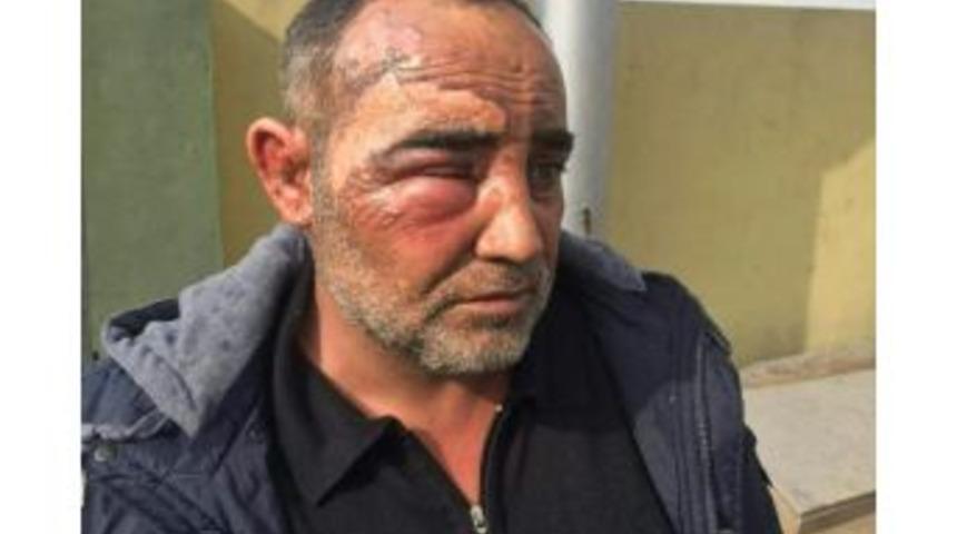 Şanlıurfalı S&uuml;r&uuml;c&uuml; Irak&rsquo;ta Yaralandı