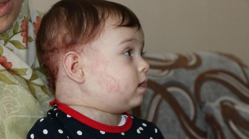 Erva Bebeğin Dramı