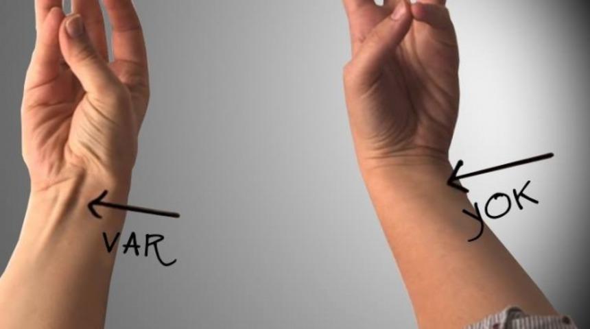 Evrimini Tamamlayan İnsanların Bileğinde Bu Kas Yok