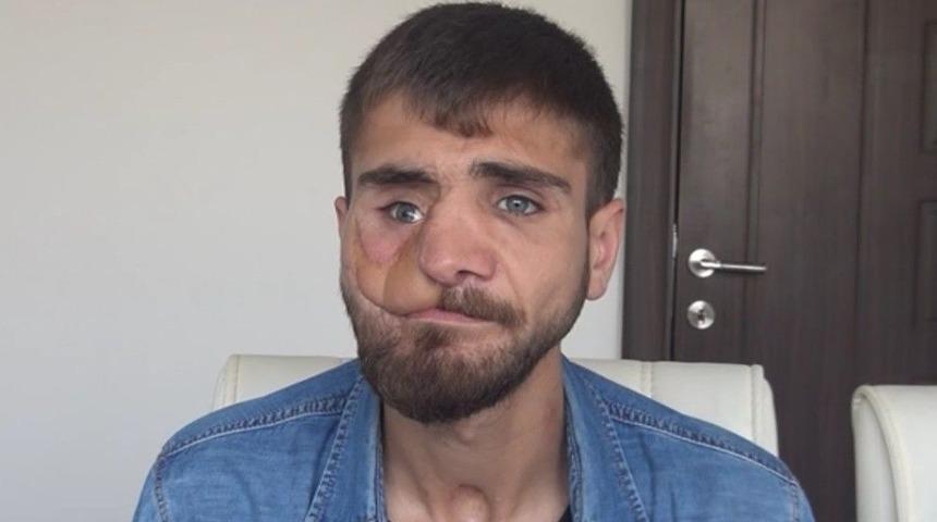 İha&rsquo;nın Haberi Ses Getirdi, Y&uuml;z&uuml;n&uuml;n Ameliyatı İ&ccedil;in Gerekli Para Toplandı