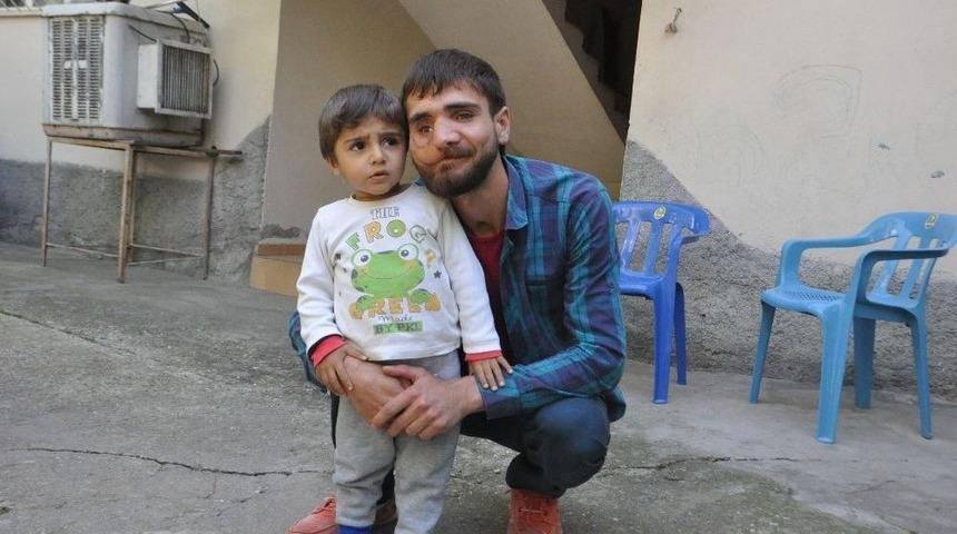 38 Kez Ameliyat Oldu, Y&uuml;z&uuml; D&uuml;zelmedi