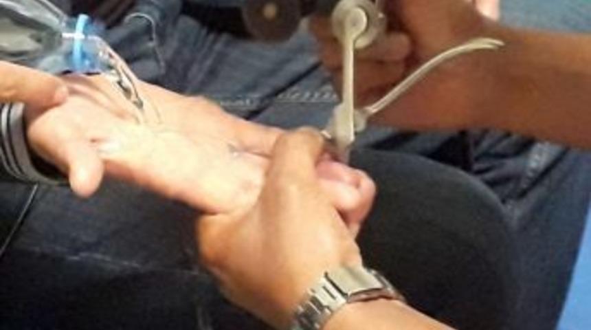 Parmağa Sıkışan Y&uuml;z&uuml;ğ&uuml; İtfaiye &Ccedil;ıkardı