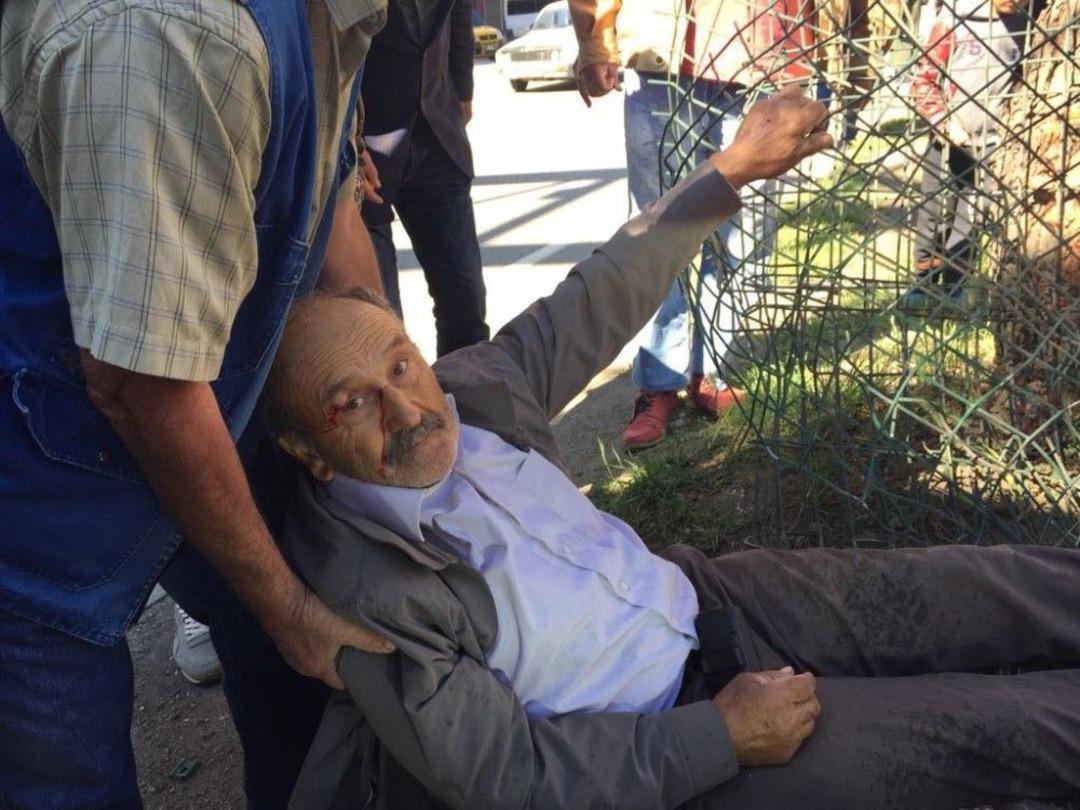 Otomobilin &Ccedil;arptığı Yaya Yaralandı