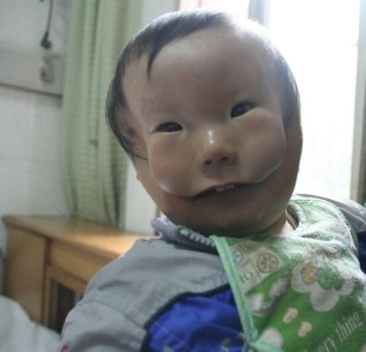 D&uuml;nyada ilk kez g&ouml;r&uuml;nen hastalık! &Ccedil;ift y&uuml;zle d&uuml;nyaya geldi