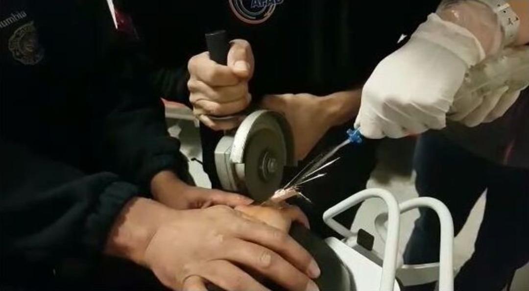 &Ccedil;ocuğun Parmağına Sıkışan Y&uuml;z&uuml;k Afad Tarafından &Ccedil;ıkarıldı