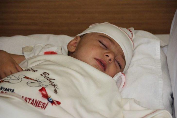 Hatay’da Kafatası Büyüyen Minik Zeynep Sağlığına Kavuştu G1