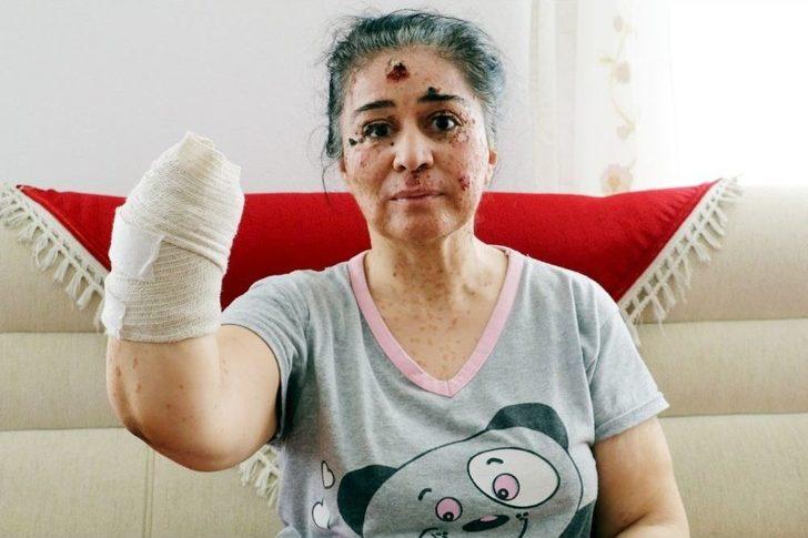 Güneşin Erittiği Kadın G2