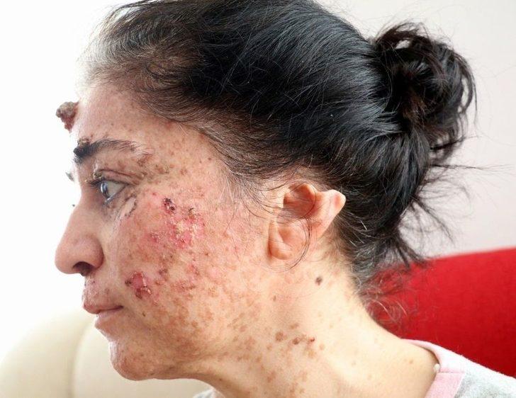 Güneşin Erittiği Kadın G4