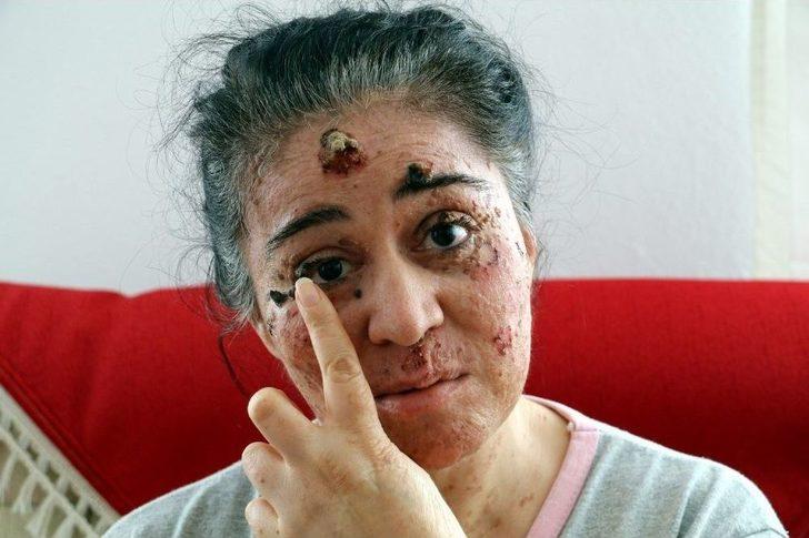 Güneşin Erittiği Kadın G5