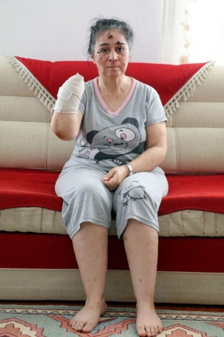 Güneşin Erittiği Kadın G1