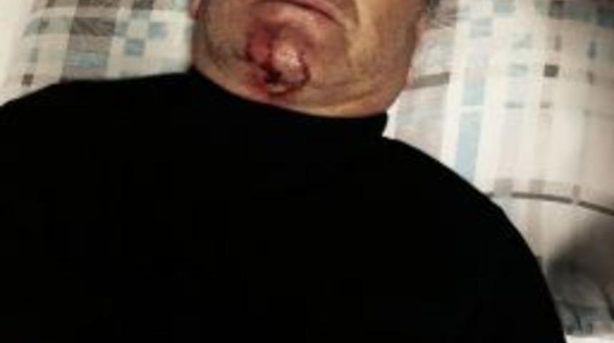 Osmaniyesporlu Eski Futbolcu Saldırıya Uğradı