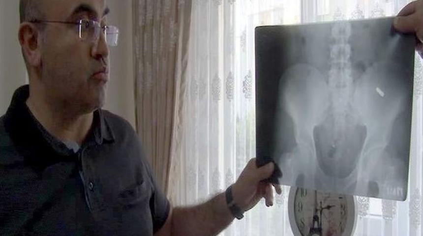 (&ouml;zel) 11 Yıldır Pkk Kurşunuyla Yaşayan Vatandaş Gazilik Onuru İstiyor