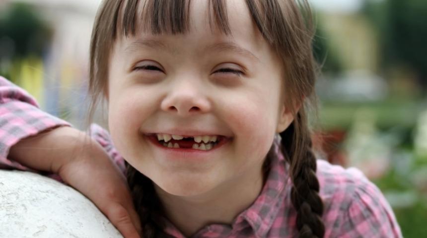 21 Mart D&uuml;nya Down Sendromu Farkındalık G&uuml;n&uuml; ve Down Sendromu Hakkında Bilinmesi Gerekenler