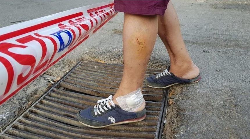 Ayağı Demir Mazgala Sıkışan Vatandaş Yaralandı