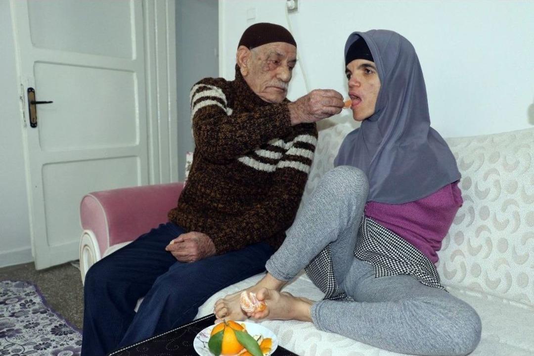 (&ouml;zel Haber) Kolsuz Hayatını Ayakları İle Aydınlattı