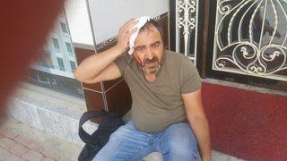 Saldırıya Uğrayan Yerel Gazeteci Hastanelik Oldu