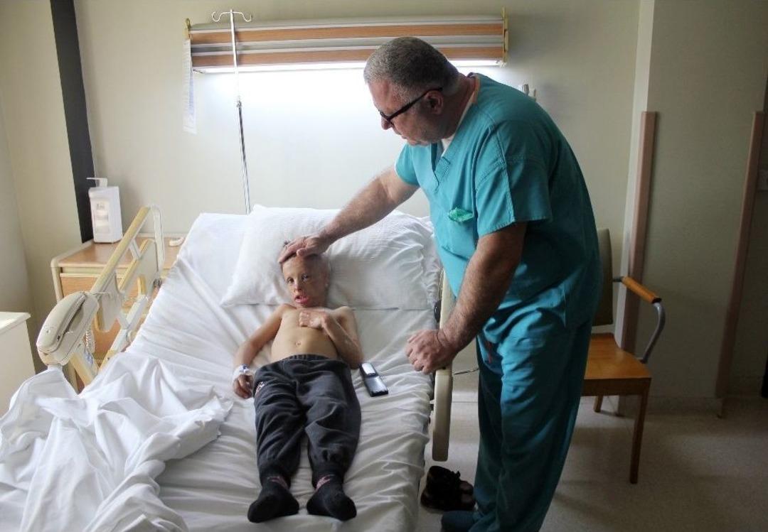 (&ouml;zel) Hakkari&rsquo;de Y&uuml;z&uuml; Ve Kafası Yanan 7 Yaşındaki &Ccedil;ocuk İstanbul&rsquo;da Ameliyat Edildi