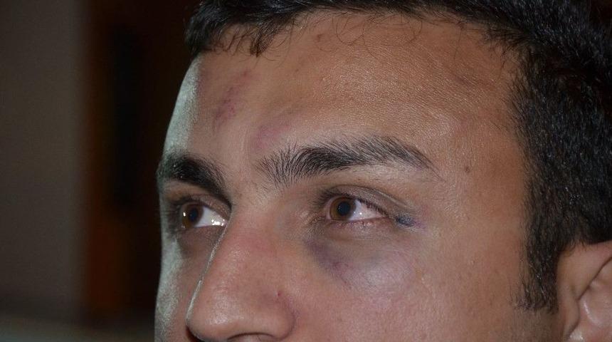 Yolcunun Otob&uuml;s Şof&ouml;r&uuml;n&uuml; Darp Ettiği İddiası