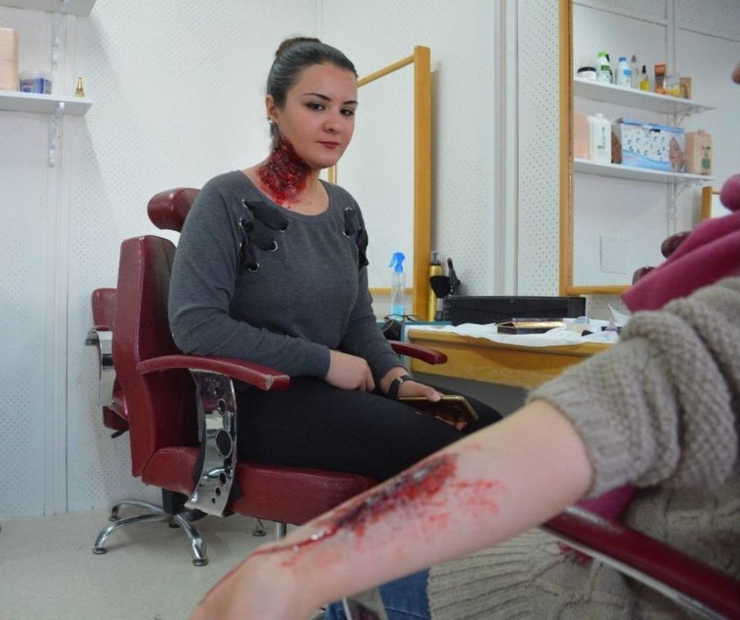 (&ouml;zel) Bu Yaralar &Ouml;l&uuml;mc&uuml;l Değil