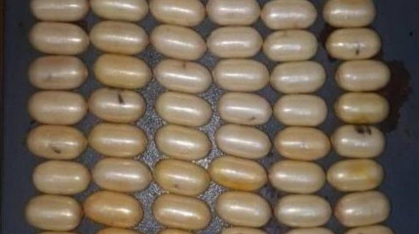 Brezilyalı Kadın Yolcunun Midesinden 116 Kaps&uuml;l Kokain &Ccedil;ıktı