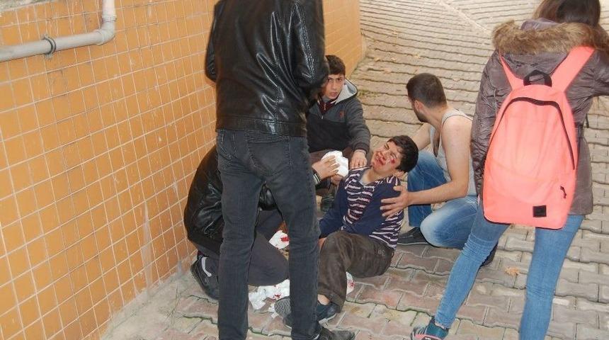 (özel Haber) Kırılan Sundurmadan Aşağıya Düşen Çocuk Yaralandı