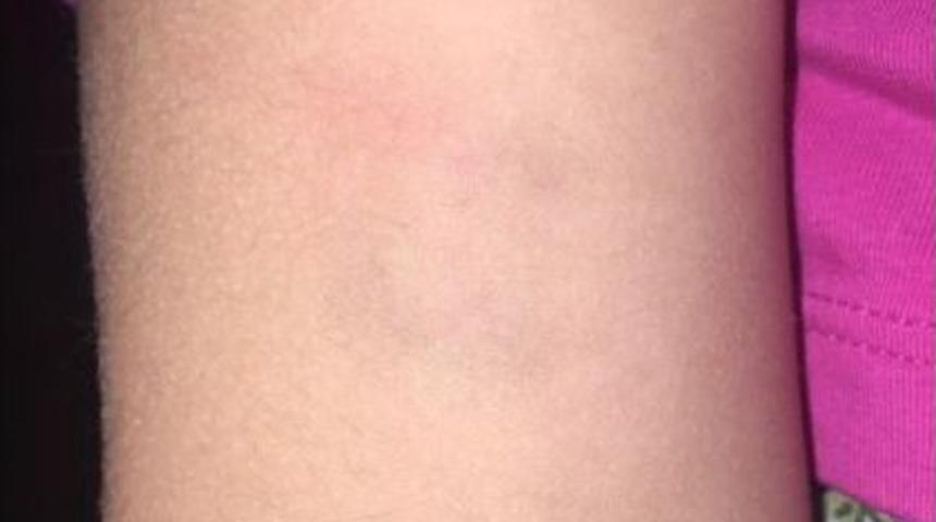 (&ouml;zel) B&uuml;y&uuml;k&ccedil;ekmece&rsquo;de G&uuml;nd&uuml;z Bakımevinde 3.5 Yaşındaki Kıza Darp İddiası