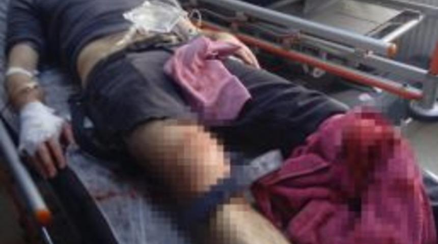 Samsun&rsquo;da &Ccedil;ay İ&ccedil;tiği Kahveyi Kurşunladı: 1 Yaralı