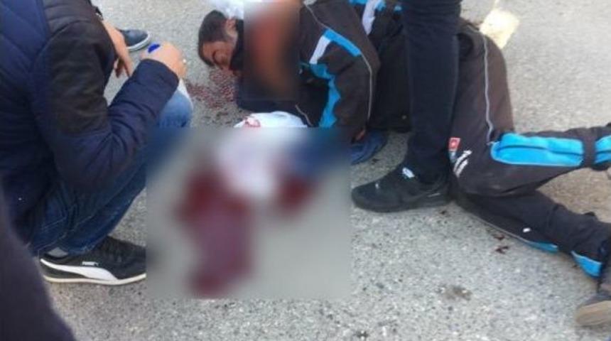 Motosikletle Otomobil Çarpıştı: 1 Yaralı