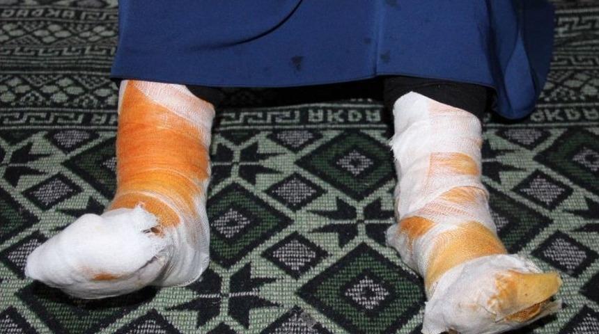 Eşinin Ve Oğlunun &Uuml;zerine Kaynar Su D&ouml;ken Kocaya 1 Ay Uzaklaştırma Cezası