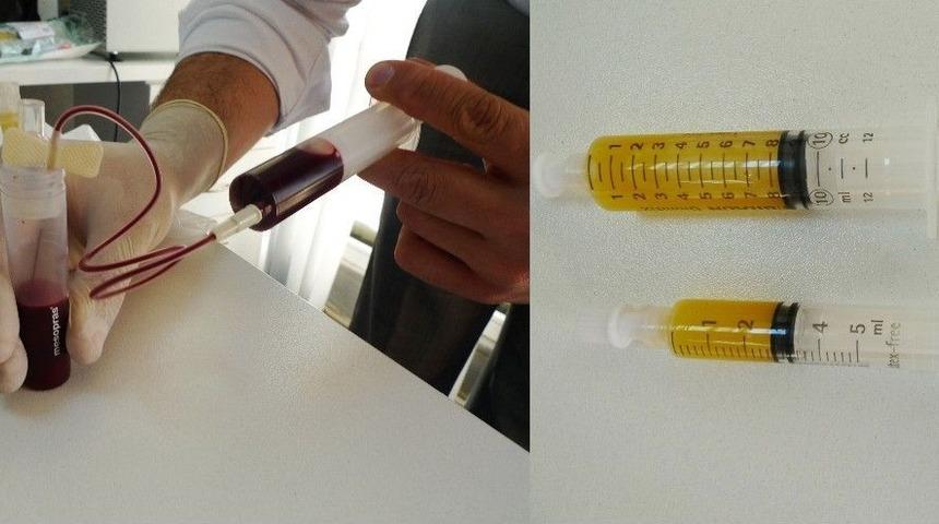 Diz Kire&ccedil;lenmesinde Prp İle K&ouml;k H&uuml;cre Tedavisi Karşılaştırması