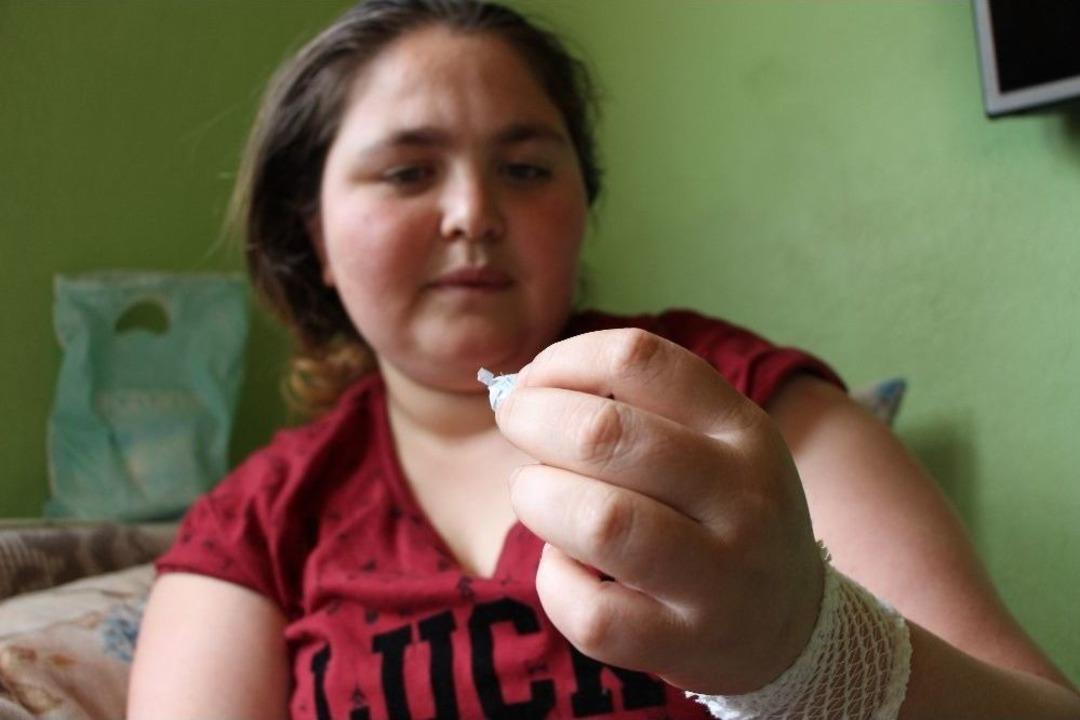 Gen&ccedil; Kızın V&uuml;cudu İğne &Uuml;retiyor