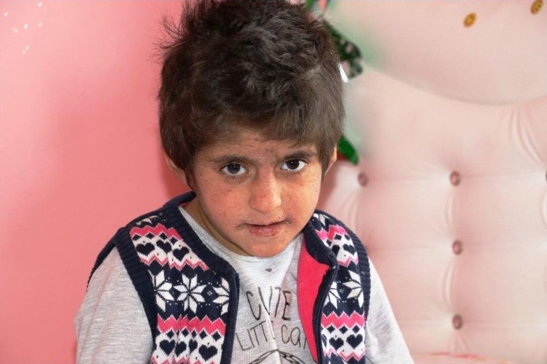 Bağışıklık Sistemi &Ccedil;&ouml;ken Minik Ecrin İ&ccedil;in İlik Nakli Gerekiyor