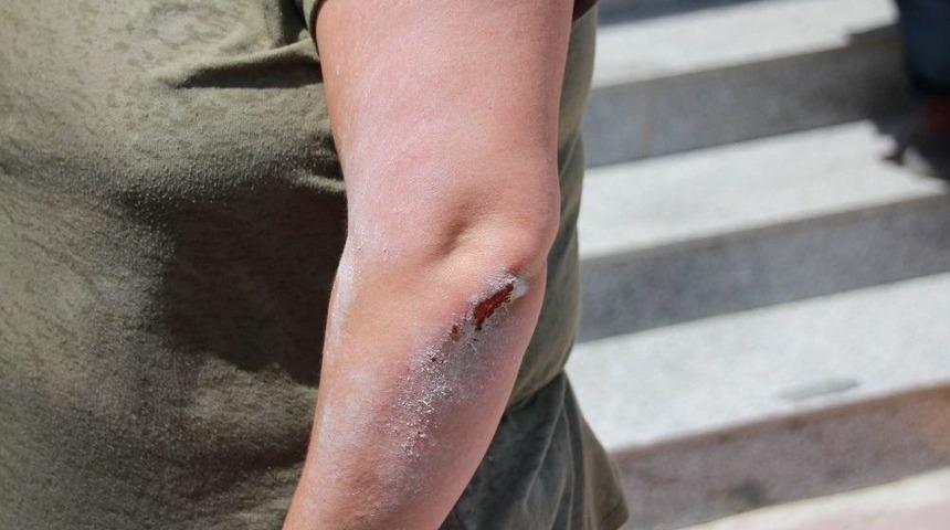 Kırşehir&rsquo;de Broş&uuml;r Dağıtan Chp Kadın Kolları Başkanına Saldırı