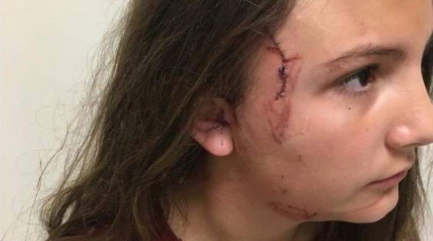 &Ccedil;ocuk Parkında Pitbul Dehşeti