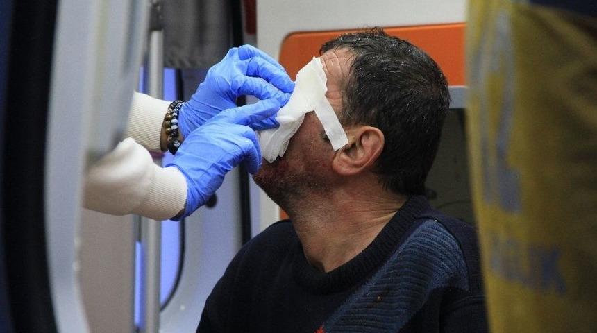 Birlikte Alkol Aldığı Arkadaşını Y&uuml;z&uuml;nden Bı&ccedil;akladı