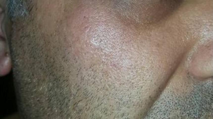 Sp Kuşadası İl&ccedil;e Başkanı Afiş Arbedesinde Yaralandı