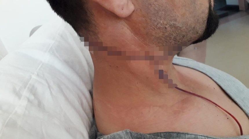 Sağlık Memuru Mesai Arkadaşını Fal&ccedil;atayla Yaraladı