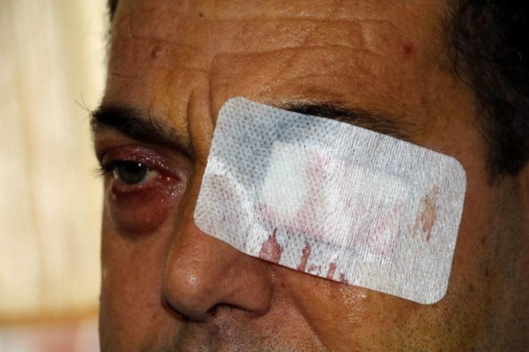 Y&uuml;zde 90 G&ouml;rme Engeli Bulunan Şahıs Emeklilik Bekliyor