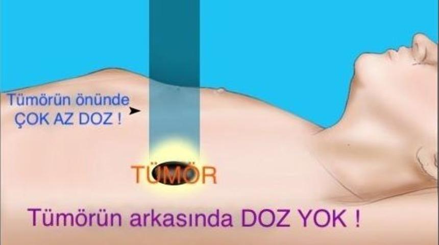 Antalya&rsquo;da Proton Kanser Tedavi Merkezi Kurulsun &Ouml;nerisi